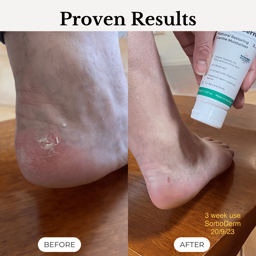 SorboDerm Natural Restoring Gentle Moisturiser