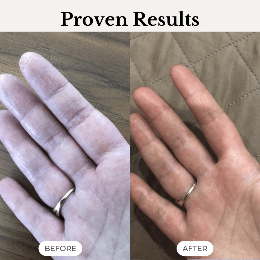 Australian skincare before and after – softer, smoother, healthier skin