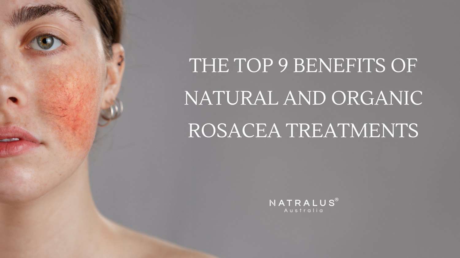 The Top 9 Benefits of Natural and Organic Rosacea Treatments