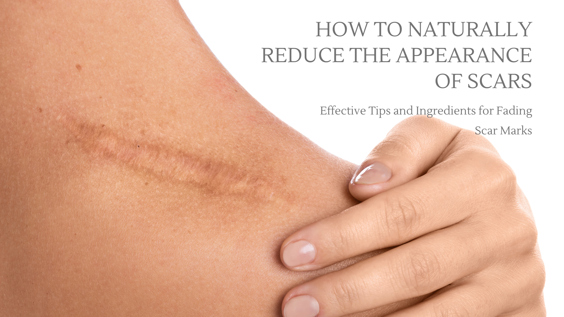 How to naturally reduce the appearance of scars