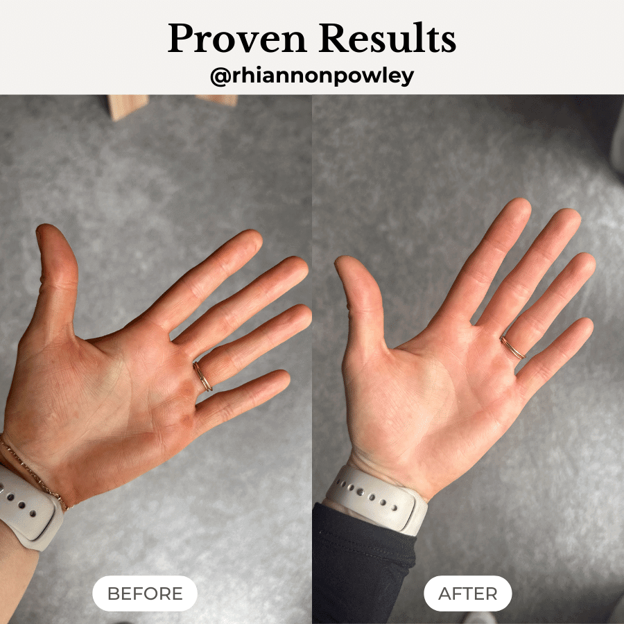 Intensive Repair for Cracked and Calloused Hands