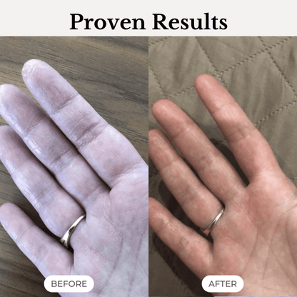 Australian skincare before and after – softer, smoother, healthier skin